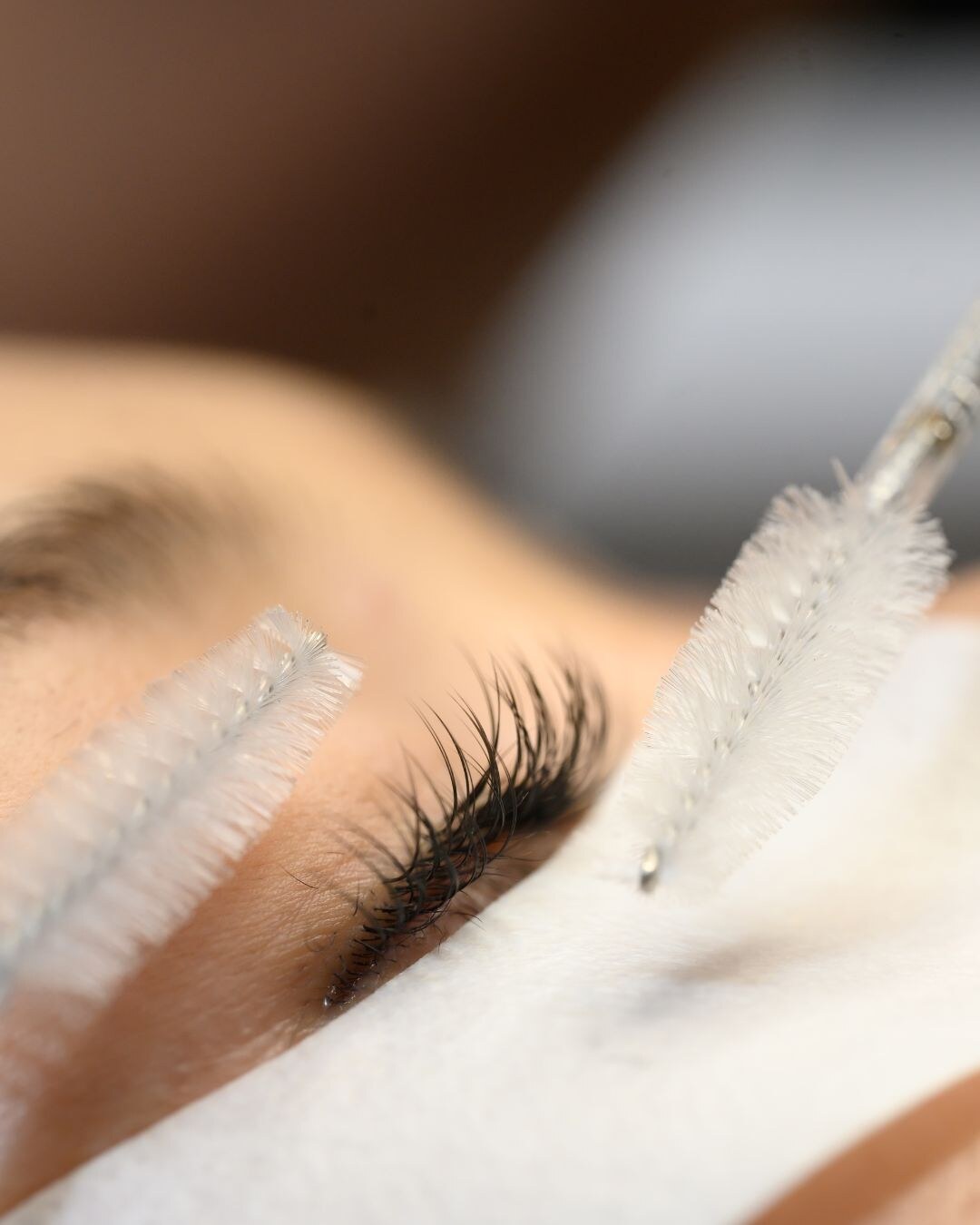 Behandlungsergebnis im Prestige Beautypoint