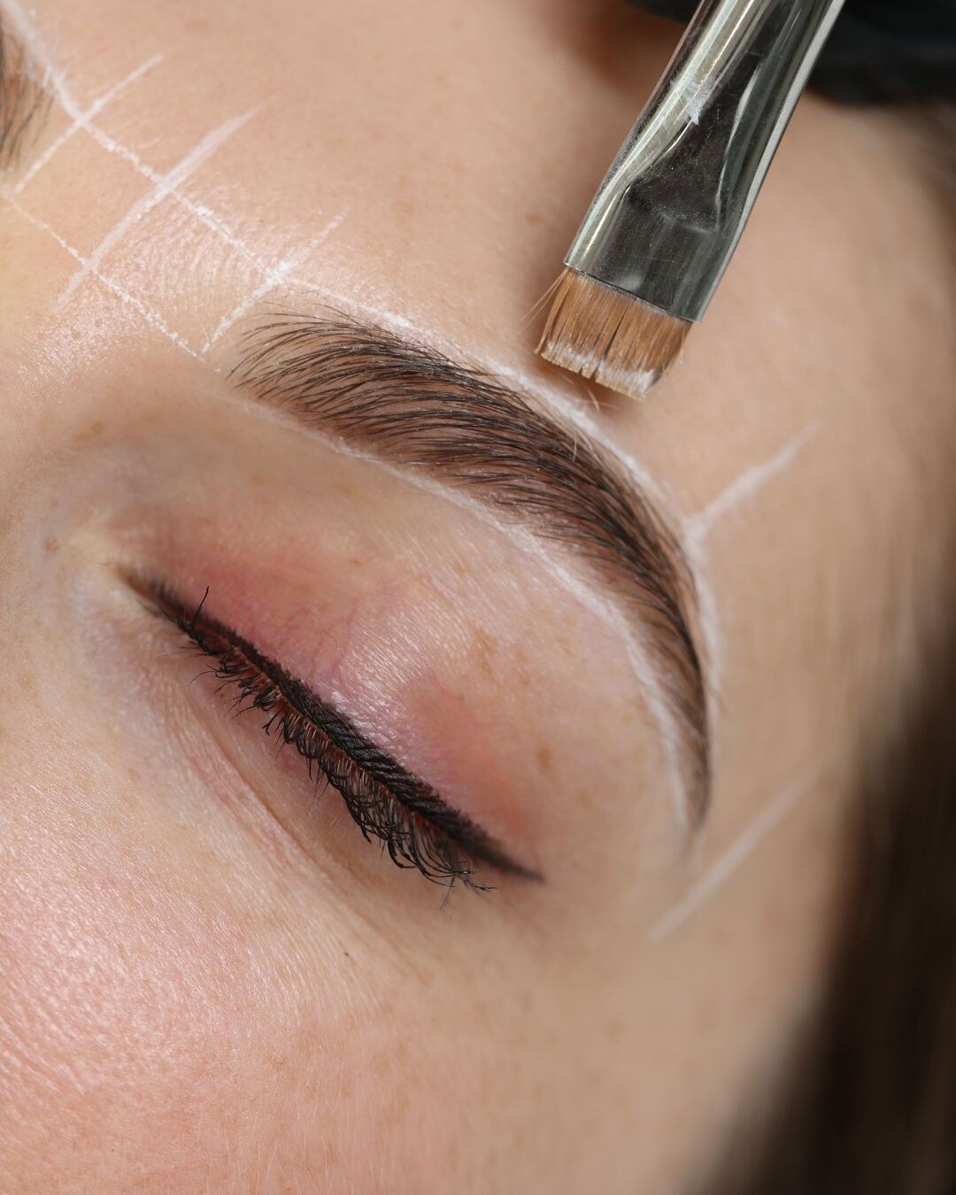 Behandlungsergebnis im Prestige Beautypoint